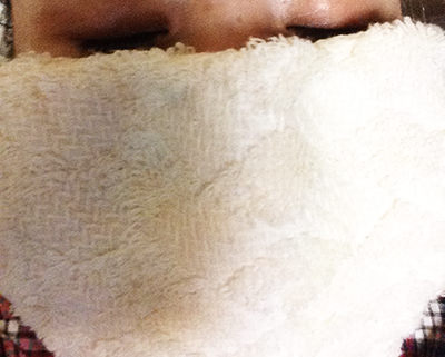 いちご鼻の治し方2. 蒸しタオル後の洗顔